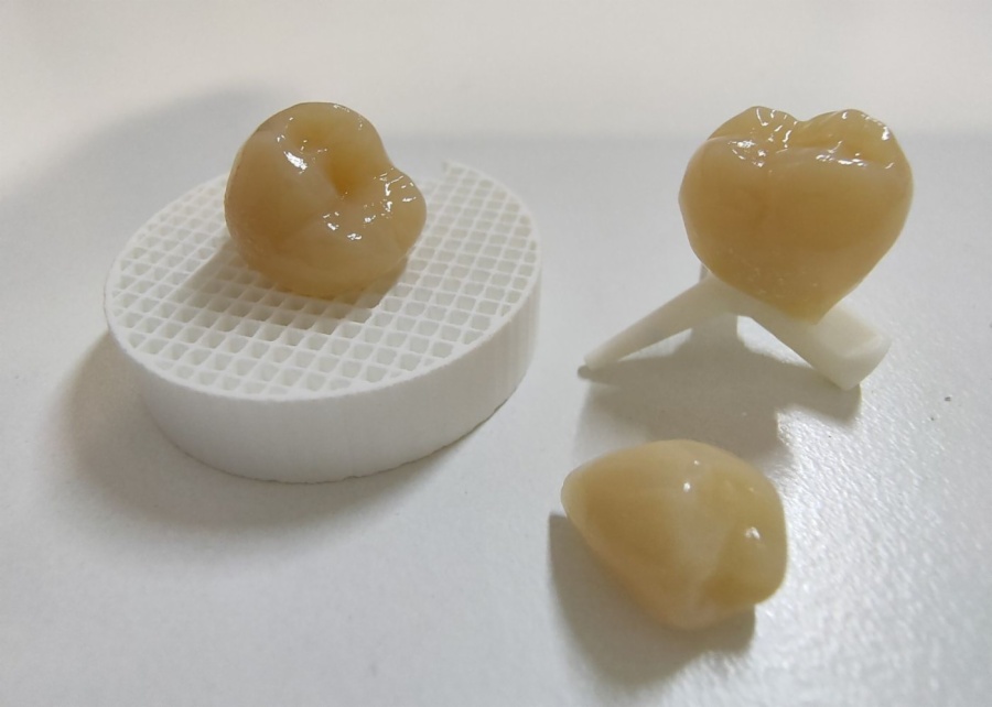 Qué es una corona dental
